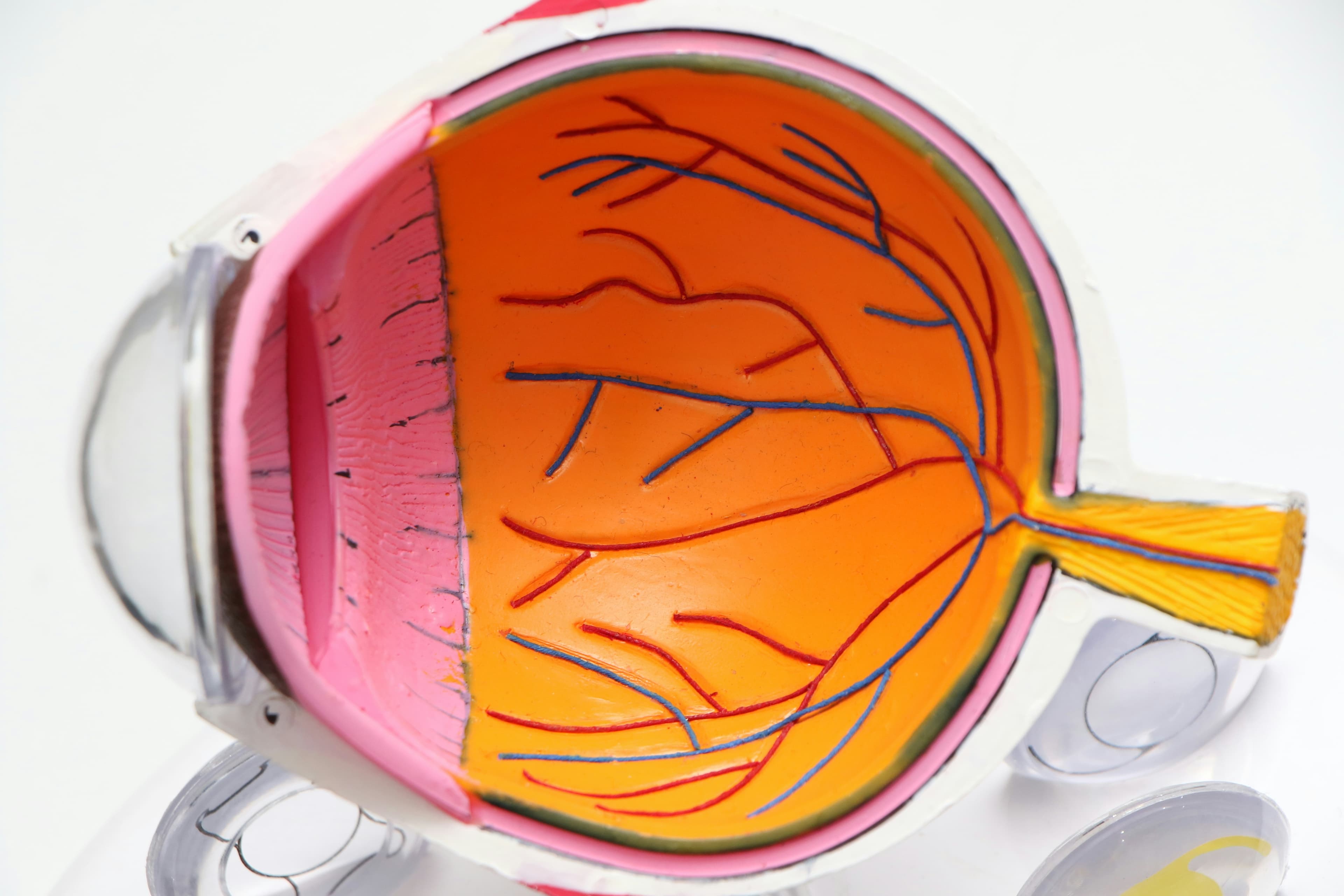 Do you need these special lens filters?